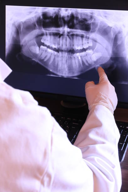 Best Emergency Gum Treatment in Gulfport, FL