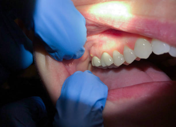 Best Emergency TMJ Treatment in Gulfport, FL
